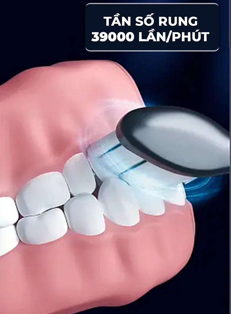 Bàn chải điện Magic Pro 50 xanh navy tần số rung 39000 lầm/phút