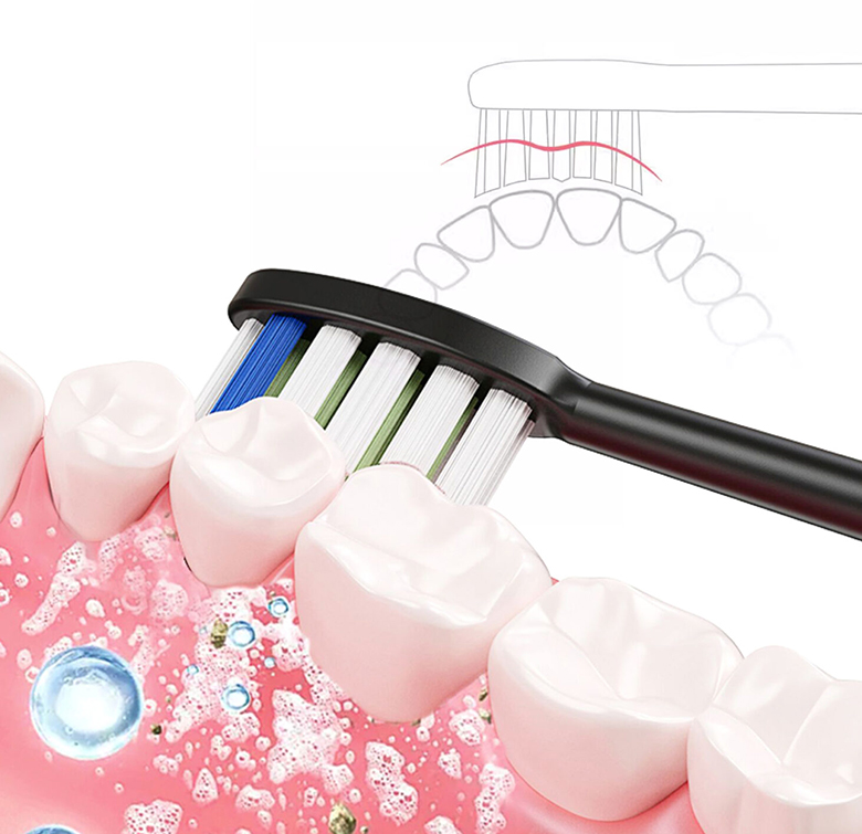 Bàn chải điện Magic B-25 trắng đầu lông mềm