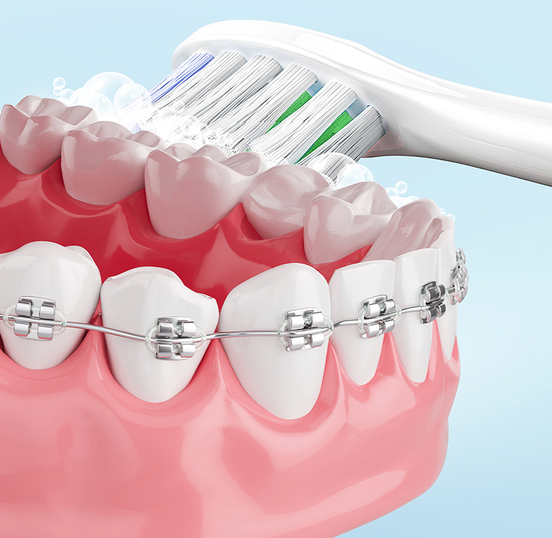 Bàn chải điện Magic B-26 tím đầu lông mềm